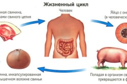 Цикл развития свиного цепня