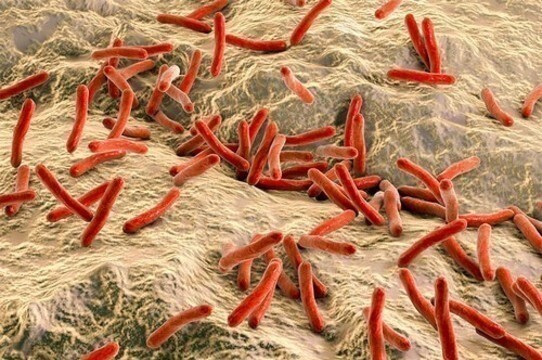 Так выглядит Mycobacterium leprae Так выглядит Mycobacterium leprae