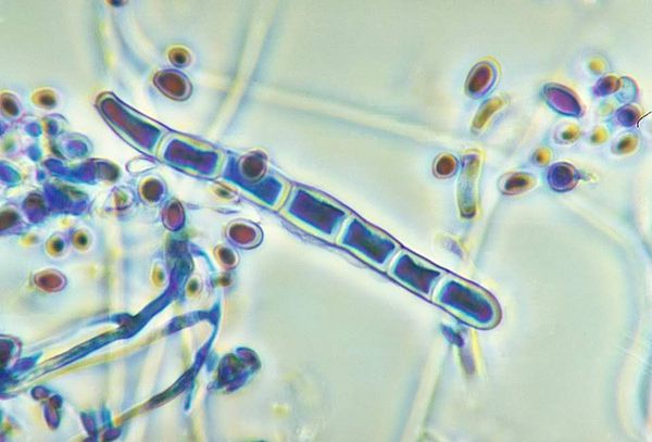 Гриб Trichophyton rubrum под микроскопом Гриб Trichophyton rubrum под микроскопом