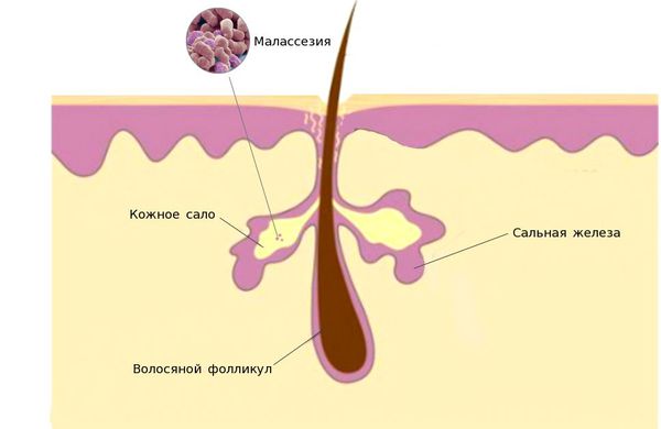 Малассезия и сальные железы