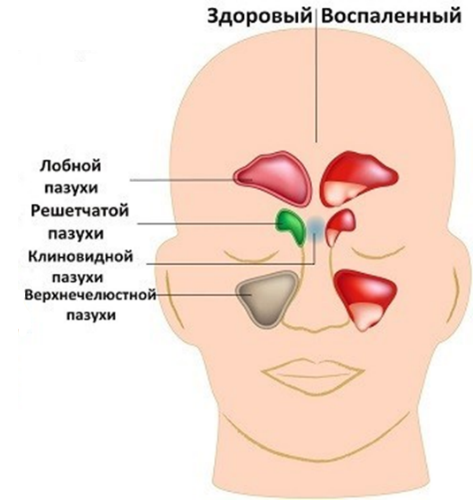 Октагель