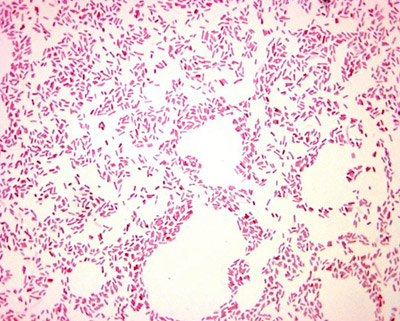 кишечная палочка colibacillus под микроскопом