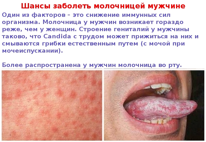 Возможность молочницы, фото