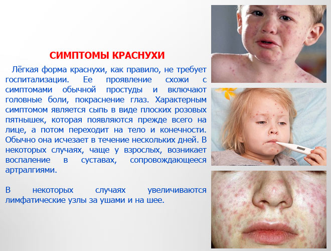Симптомы краснухи, фото