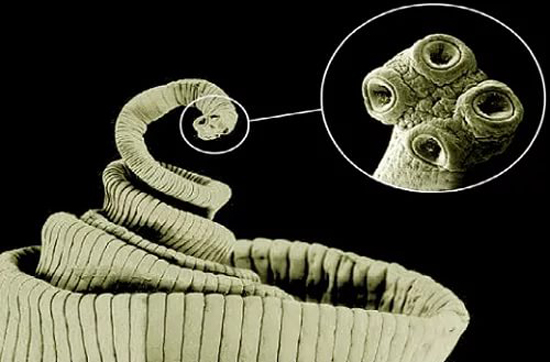 Taenia saginata