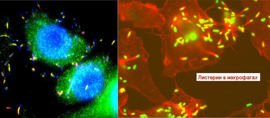 listeria monocytogenes фото возбудителей листериоза