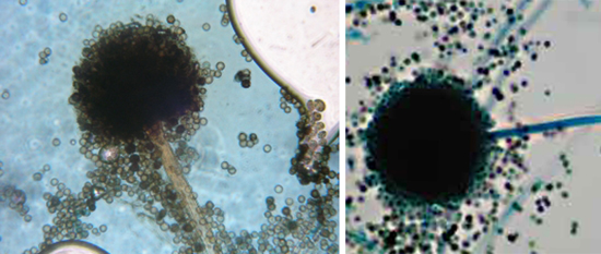 Строение A niger aspergillus типично для грибов