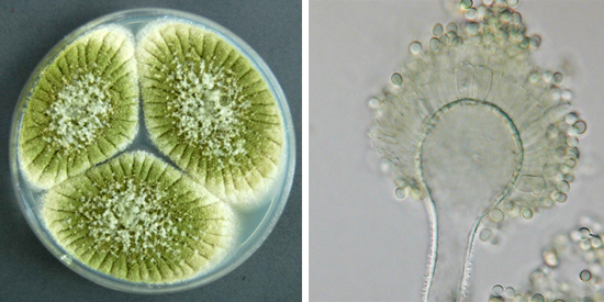 Колонии Aspergillus могут быть желто-зеленого цвета