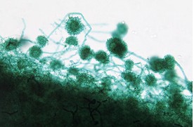 Мод видимых спор Aspergillus под микроскопом