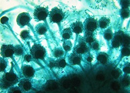 Aspergillus можно увидеть под микроскопом