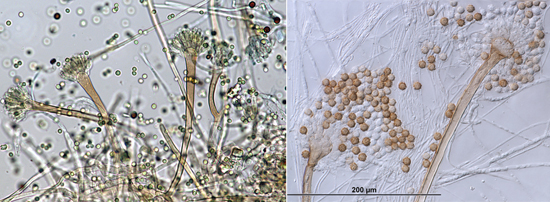 На фото споры грибов Aspergillus