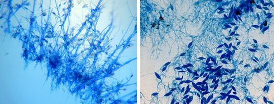 патогенные грибы Microsporum