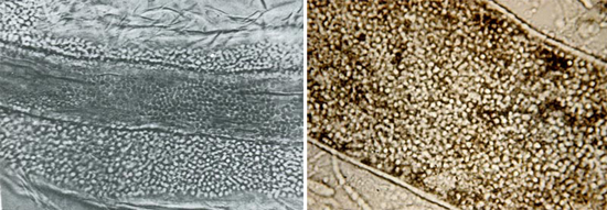 грибы Trichophyton могут влиять как на внешнюю, так и на внутреннюю структуру волос